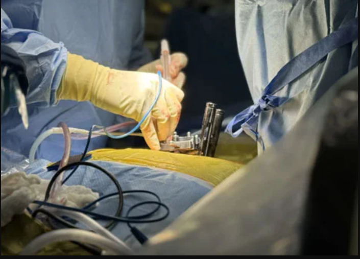 Transforming Back Care Through Least‑Invasive Spine Surgery