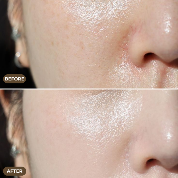 Top Skin Whitening Treatments in Dubai: What You Need to Know