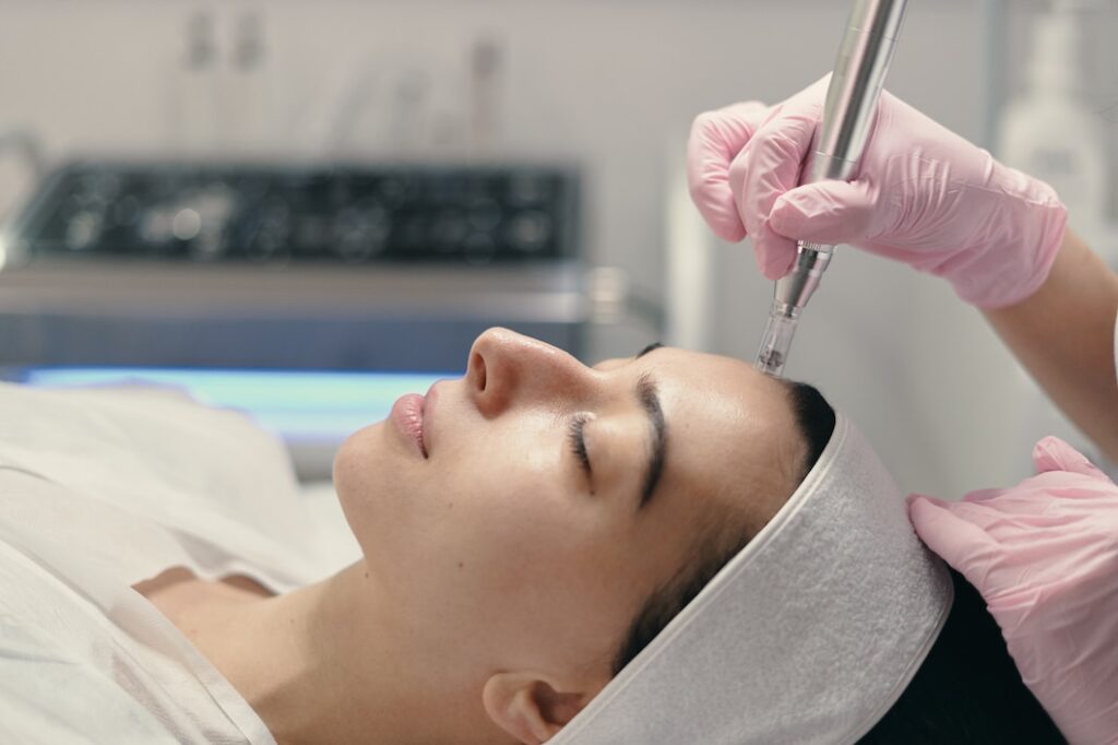Radiofrequency Microneedling