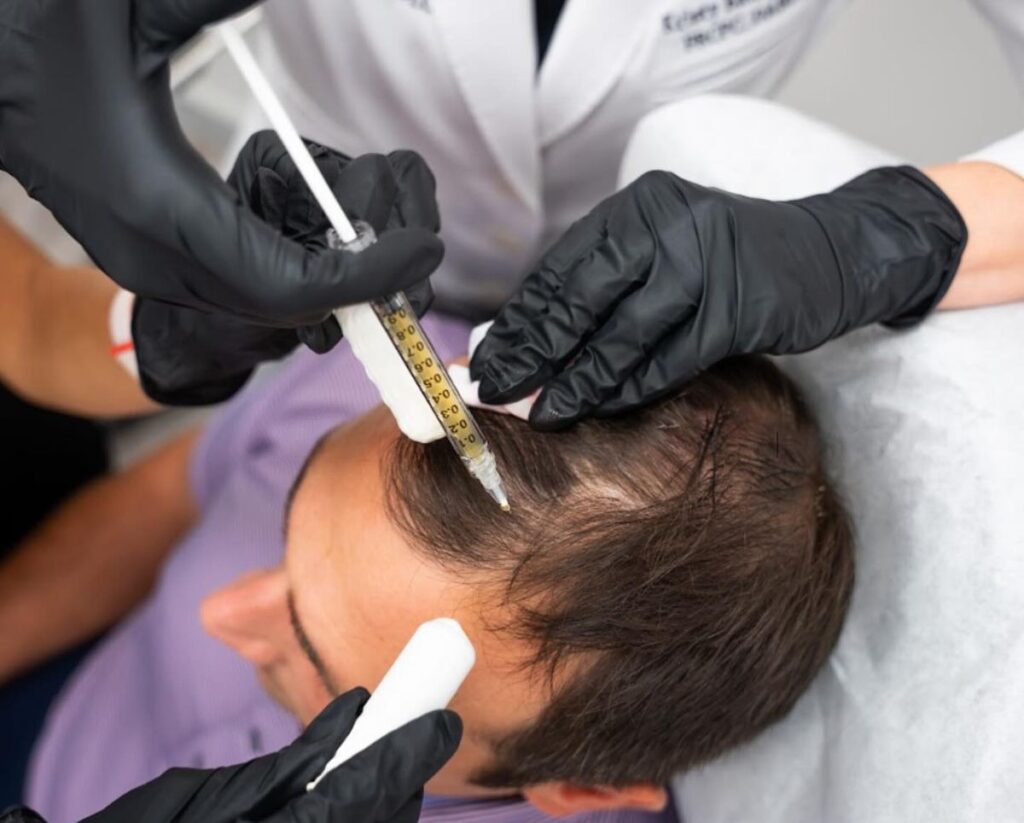 Safe PRP Hair Regrowth Treatment in Islamabad, Pakistan